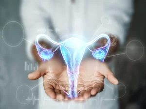 درمان کیست دموئید یا مویی تخمدان - دکتر فاطمه ارشادی