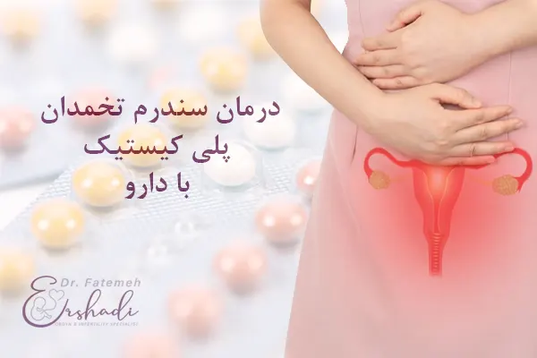 بهترین قرص برای درمان تخمدان پلی کیستیک
