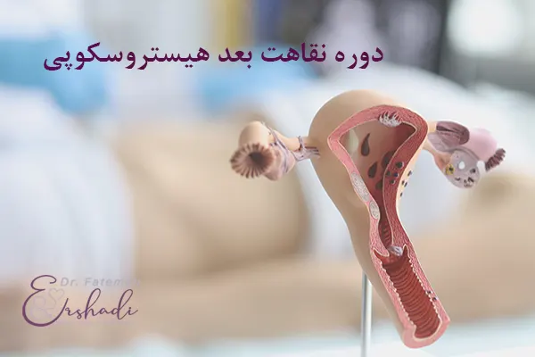 مراقبت های بعد از هیستروسکوپی