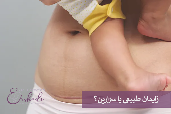 زایمان طبیعی یا سزارین؟