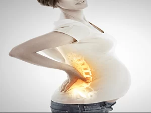 علائم دیسک کمر در بارداری