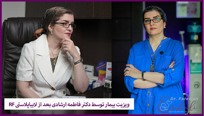 ویزیت دکتر فاطمه ارشادی بعد لیزر RF لابیاپلاستی