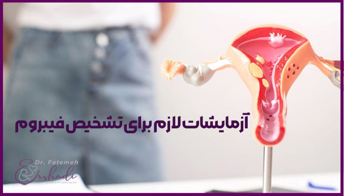 آزمایشات لازم برای تشخیص فیبروم