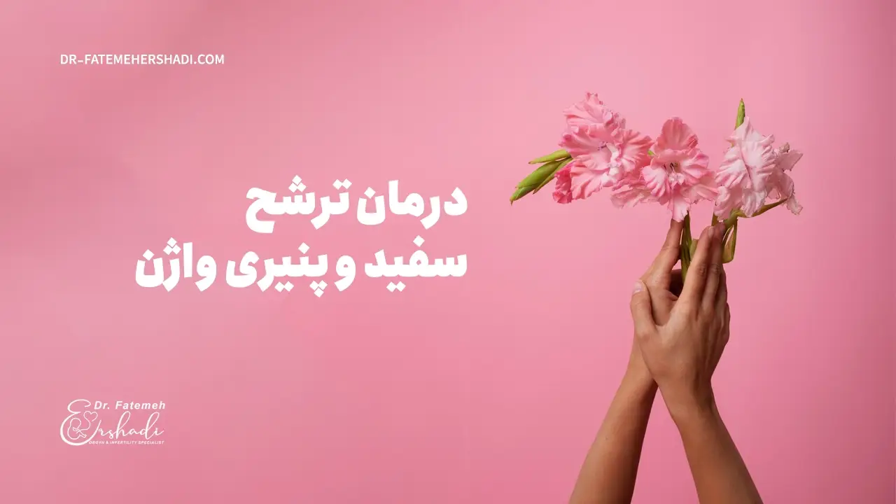 درمان ترشح سفید پنیری واژن